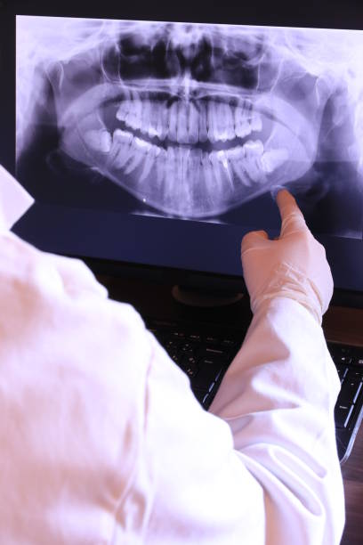 Best Emergency Treatment for Dental Infections or Abscesses in Anderson, IN