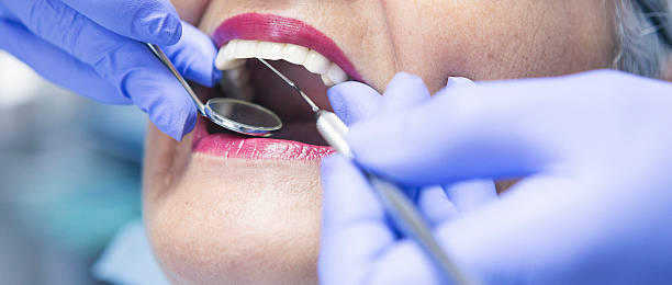 Best Emergency Dental Care for Broken or Chipped Teeth in Anderson, IN